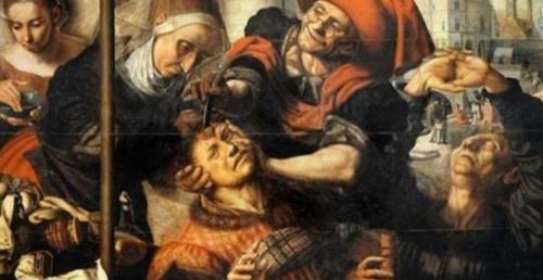 Phát hiện bí ẩn đằng sau việc người cổ đại khoan sọ?.