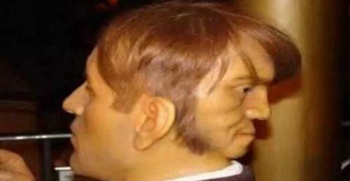 Bí ẩn về những người đàn ông hai mặt khiến y học bối rối