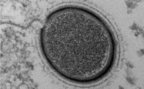 Hồi sinh virus có tuổi thọ 30.000 năm trong băng vĩnh cửu?