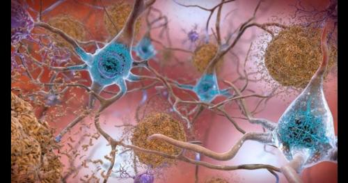 Nếu không muốn bộ não của bạn bị tổn thương hãy bỏ ngay 10 thói quen này